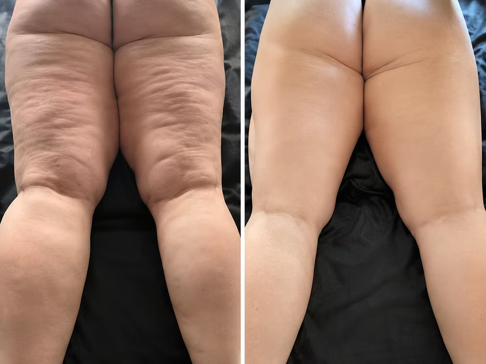 Transformación antes y después con BLOOM